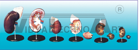 The model of kidney